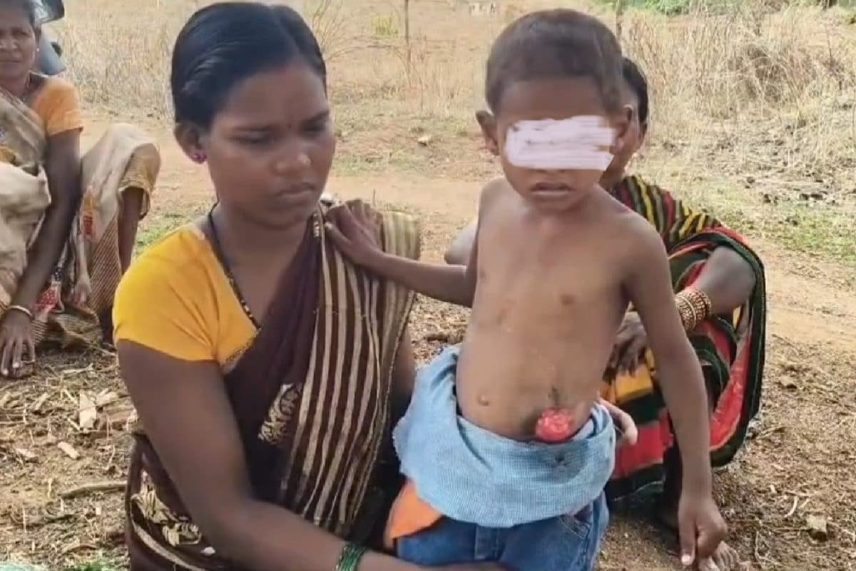 जन्म के साथ ही दुर्लभ बीमारी का शिकार है बच्चा, बिना मलद्वार के है जिंदा, इलाज के लिए तड़प रहा मासूम